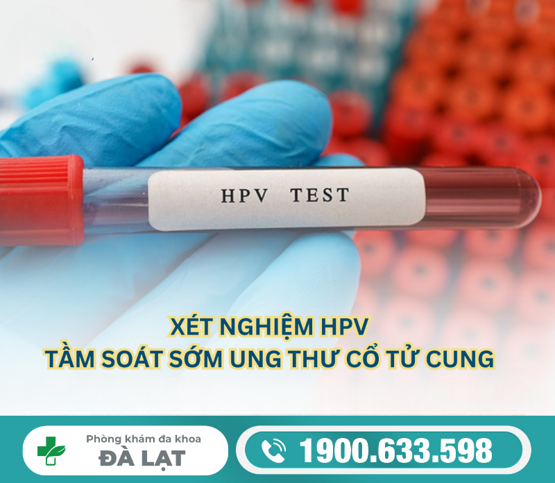 Hình ảnh minh họa